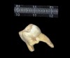 Dent néandertalienne